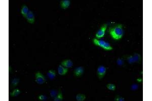Immunofluorescence staining of Hela cells with ABIN7176698 at 1:50, counter-stained with DAPI. (SLC39A1 antibody  (AA 41-317))