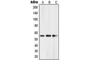 Western blot analysis of PKNOX2 expression in HeLa (A), mouse kidney (B), rat kidney (C) whole cell lysates. (PKNOX2 antibody  (C-Term))