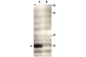 Image no. 1 for anti-Centromere Protein Q (CENPQ) antibody (ABIN1100754) (CENPQ antibody)