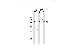 All lanes : Anti-AIRE Antibody (Center) at 1:2000 dilution Lane 1: Hela whole cell lysate Lane 2: U-20S whole cell lysate Lane 3: K562 whole cell lysate Lysates/proteins at 20 μg per lane.