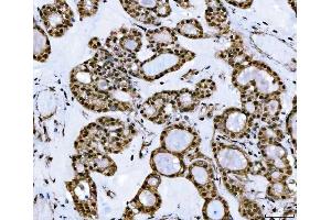 IHC analysis of TIP49A/RUVBL1 using anti-TIP49A/RUVBL1 antibody (ABIN7599928).