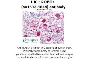 Image no. 1 for anti-Roundabout, Axon Guidance Receptor, Homolog 1 (ROBO1) (AA 1632-1644) antibody (ABIN1738905)