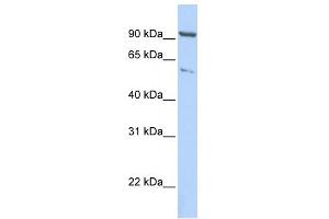 WB Suggested Anti-KIF2A Antibody Titration:  0. (KIF2A antibody  (C-Term))