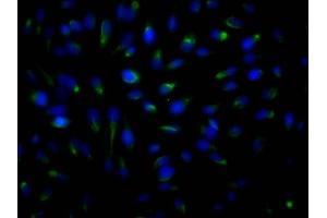 Immunofluorescence staining of Hela Cells with ABIN7127797 at 1:50, counter-stained with DAPI. (Recombinant ROCK2 antibody)