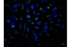 Immunofluorescence staining of Hela Cells with ABIN7127797 at 1:50, counter-stained with DAPI. (Recombinant ROCK2 antibody)