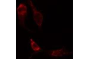 ABIN6275203 staining Hela cells by IF/ICC. (DCT antibody  (N-Term))