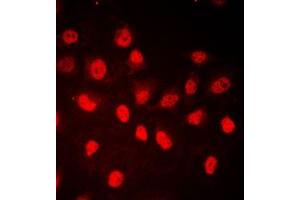 Immunofluorescent analysis of RB1 (pS780) staining in HeLa cells. (Retinoblastoma 1 antibody  (C-Term, pSer780))