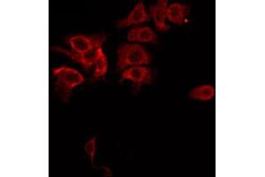 ABIN6267685 staining MDA-MB-435 by IF/ICC. (ASK1 antibody  (pSer83))