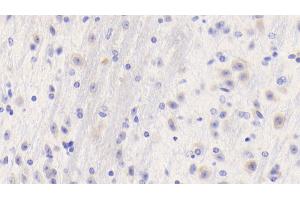 Detection of FGg in Mouse Cerebellum Tissue using Polyclonal Antibody to Fibrinogen Gamma (FGg)