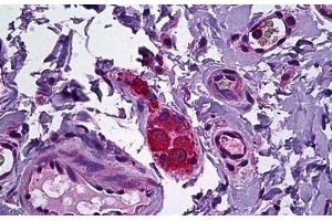 Human Intestine, Ganglion Cells: Formalin-Fixed, Paraffin-Embedded (FFPE) (NPY5R antibody  (AA 241-252))