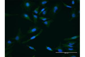 Immunofluorescence of purified MaxPab antibody to PPID on HeLa cell. (PPID antibody  (AA 1-370))