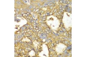 Immunohistochemistry (IHC) image for anti-Protein Kinase, CAMP-Dependent, Regulatory, Type I, alpha (Tissue Specific Extinguisher 1) (PRKAR1A) (AA 1-250) antibody (ABIN6214019) (PRKAR1A antibody  (AA 1-250))