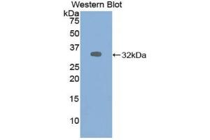 Detection of Recombinant ALDOA, Human using Polyclonal Antibody to Aldolase A, Fructose Bisphosphate (ALDOA) (ALDOA antibody  (AA 18-273))