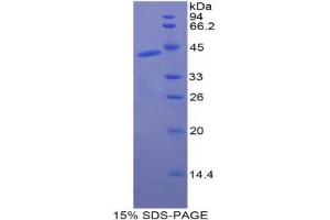 SDS-PAGE analysis of Dog CKM Protein.