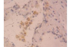 Detection of CLCF1 in Human Lung Tissue using Polyclonal Antibody to Cardiotrophin Like Cytokine Factor 1 (CLCF1) (CLCF1 antibody  (AA 88-190))