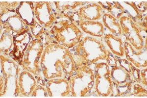 Immunohistochemistry of paraffin-embedded Human kidney using FGB Polycloanl Antibody at dilution of 1:200 (Fibrinogen beta Chain antibody)