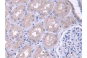 Detection of FARS2 in Human Kidney Tissue using Polyclonal Antibody to Phenylalanyl tRNA Synthetase 2, Mitochondrial (FARS2) (FARS2 antibody  (AA 1-451))