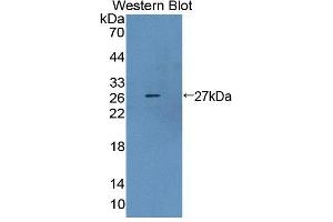 Western blot analysis of the recombinant protein. (Ancient Ubiquitous Protein 1 antibody  (AA 201-410))