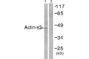 Western blot analysis of extracts from COLO205 cells, using Actin-γ2 antibody. (ACTG2 antibody)