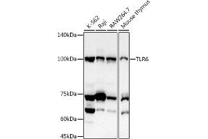 Western blot analysis of extracts of various cell lines, using TLR6 antibody (ABIN7270847) at 1:1000 dilution. (TLR6 antibody  (AA 32-200))