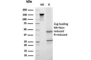 SDS-PAGE Analysis Purified Monospecific Mouse Monoclonal Antibody to Transferrin (TF/3001). (Transferrin antibody  (AA 311-445))