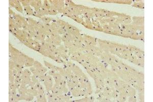 Immunohistochemistry of paraffin-embedded human heart tissue using ABIN7151077 at dilution of 1:100 (MYLIP antibody  (AA 266-445))