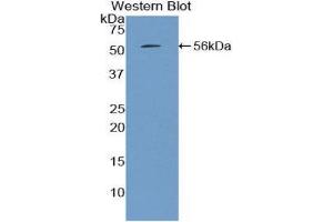 Western Blotting (WB) image for anti-Mannose-Binding Lectin (Protein C) 2, Soluble (MBL2) (AA 19-244) antibody (ABIN1859767) (MBL2 antibody  (AA 19-244))