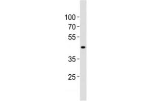 Western blot analysis of lysate from human kidney tissue lysate using SOX7 antibody diluted at 1:1000. (SOX7 antibody  (AA 224-258))
