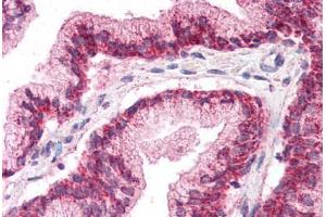 Human Prostate (formalin-fixed, paraffin-embedded) stained with LHX2 antibody ABIN337089 at 5 ug/ml followed by biotinylated goat anti-rabbit IgG secondary antibody ABIN481713, alkaline phosphatase-streptavidin and chromogen. (LHX2 antibody  (AA 239-254))