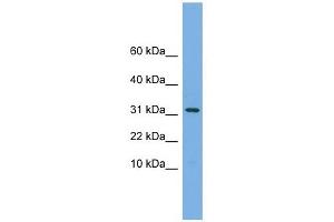 MRPS6 antibody used at 1 ug/ml to detect target protein.