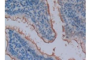 Detection of ENPEP in Rat Small intestine Tissue using Polyclonal Antibody to Aminopeptidase A (ENPEP) (ENPEP antibody  (AA 409-624))