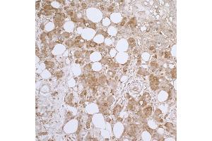 Immunohistochemistry (IHC) image for anti-Heat Shock 27kDa Protein 1 (HSPB1) (AA 155-205) antibody (ABIN7453920)
