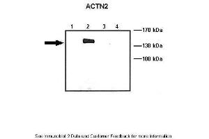 Lanes:   Lane1: 10 ug ACTN1-GFP transfected COS-7 lysate Lane2: 10 ug ACTN2-GFP transfected COS-7 lysate Lane3: 10 ug ACTN3-GFP transfected COS-7 lysate Lane4: 10 ug ACTN4-GFP transfected COS-7 lysate  Primary Antibody Dilution:   1: 1000  Secondary Antibody:   Anti-rabbit HRP  Secondary Antibody Dilution:   1:5000  Gene Name:   ACTN2  Submitted by:   Johannes W. (ACTN2 antibody  (C-Term))