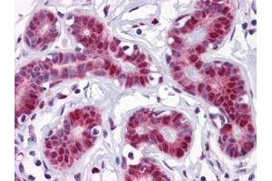 Immunohistochemistry (IHC) image for anti-TSC22 Domain Family, Member 3 (TSC22D3) (AA 1-98) antibody (ABIN614600) (TSC22D3 antibody  (AA 1-98))
