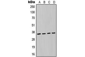 Western blot analysis of MAGEA6 expression in A549 (A), MCF7 (B), NIH3T3 (C), H9C2 (D) whole cell lysates. (MAGEA6 antibody  (Center))