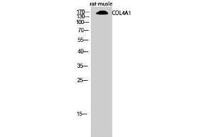 Western Blotting (WB) image for anti-Collagen, Type IV, alpha 1 (COL4A1) (N-Term) antibody (ABIN3174484) (COL4A1 antibody  (N-Term))