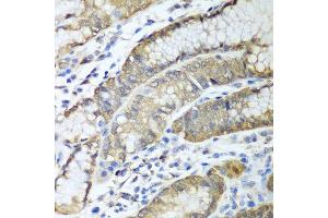Immunohistochemistry of paraffin-embedded human stomach using ADH1C antibody at dilution of 1:100 (40x lens). (ADH1C antibody)