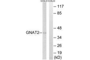 Western blot analysis of extracts from COLO cells, using GNAT2 antibody. (GNAT2 antibody)