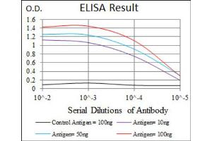 Red: Control Antigen (100ng) ; Purple: Antigen (10ng) ; Green: Antigen (50ng) ; Blue: Antigen (100ng). (Moesin antibody)