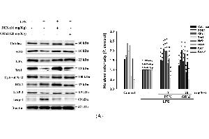 Western Blotting (WB) image for anti-Tripartite Motif Containing 28 (TRIM28) antibody (ABIN2855331)