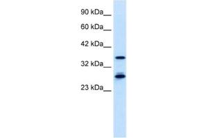 Western Blotting (WB) image for anti-Metal Response Element Binding Transcription Factor 2 (MTF2) antibody (ABIN2460909) (MTF2 antibody)