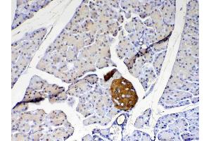 Immunohistochemistry (IHC) image for anti-Parkinson Protein 7 (PARK7) (AA 2-189) antibody (ABIN5519050)
