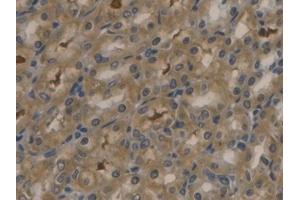 Immunohistochemistry (IHC) image for anti-Apolipoprotein B (APOB) (AA 2747-2913) antibody (ABIN7429130)
