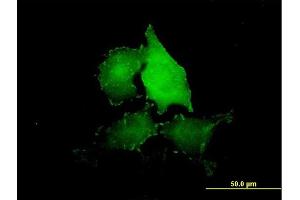 Immunofluorescence of purified MaxPab antibody to TNS4 on HeLa cell. (Tensin 4 antibody  (AA 1-480))