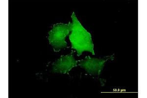 Immunofluorescence of purified MaxPab antibody to TNS4 on HeLa cell.