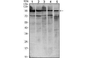 Western blot analysis using STAT6 mouse mAb against HEK293 (1), NIH/3T3 (2), MCF-7 (3), Raw246. (STAT6 antibody)