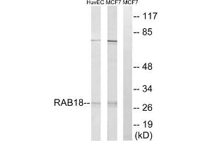 Western blot analysis of extracts from HuvEc cells and MCF-7 cells, using RAB18 antibody. (RAB18 antibody  (Internal Region))