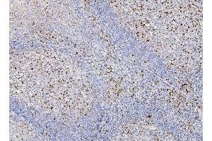 IHC analysis of RAB27A using anti-RAB27A antibody (ABIN7602714). (RAB27A antibody  (AA 98-216))