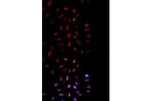 Immunofluorescence analysis of MCF-7 cells using Phospho-FOS-T232 antibody (ABIN5969895). (c-FOS antibody  (pThr232))