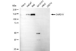 Western blotting analysis using CARD11 antibody (ABIN7797915).